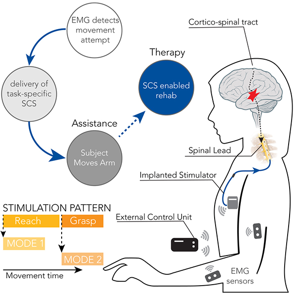 Spine Stimulation Patterns